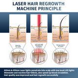 Hair Growth Newly Hair-Growth Laser Machine /650nm Diode Lasers Hair Regrowth Device