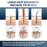 Most Popular Hair Loss Treatment Laser Hair Growth Machine Laser Hair Grow Device