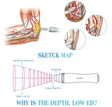 Effective acoustic shock wave Gain therapy function pain removal for erectile dysfunction/ED treatment  ISO