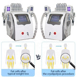 Body Slimming Ultrasound Rf Liposuction Lipo Laser Machine With 2 Cryo Handle Work At Same Time