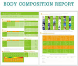 Hot Sale Body Composition Analysis Fat Analyzer Body Fat Analyzer With Hp A4 Printer Measurement Machine Analysis