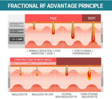 Fractional Microneedle RF beauty Machine Skin Tightening Face lifting/Skin care beauty machine