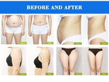 High Tech 4 Cryo Handles Liposuction Lipo Freeze Lipo Slimming Weight Reduce Beauty Machine