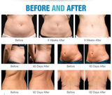 Cryolipolysis Fat Freeze Cryotherapy Body Slimming 40K Cavitation Lipolaser Fat Burning