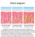 Newest Skin Tightening Ultramage Combined With 4 Handles 9D Hifu +Fractional Rf+ Lipo Hifu+ Mesogun No Needles