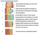 4 IN 1 cryolipolysis fat freeze slimming body sculpting 2 cryo handles 40K cavitation RF salon