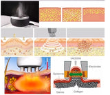 2021 Versatile Micro Needling Fractional Miltipolar Radio Frequency 40K Ultrasonic Cavitation Non-Surgical Liposuction