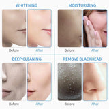 10 In 1 Hydro Clean Beauty Salon Microdermabrasion Microcurrent Elastic Machine Rf Skin Care Wrinkle Removal