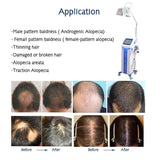 High Quality Bio Light Hair Growth Equipment / 650nm Laser Diode Hair Growth Machine