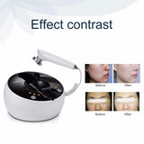 RF Radio Frequency Facial And Body Skin Tightening Machine - Ultrasonic facial beauty device