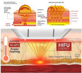 Vmax HIFU High Intensity Focused Ultrasound HIFU Face Lifting Wrinkle Removal With 1.5mm,3.0mm,4.5mm Cartridges