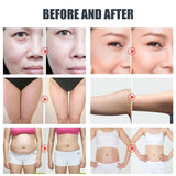 5 in 1 40K Ultrasonic Cavitation Slimming Liposuction Multipolar RF Skin Tightening Cellulite Reduction Body Face Lift weight loss Machine