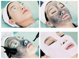 Soft Laser Black Doll Carbon Cream Gel Powder Switched Nd Yag Laser Natural Toner For Spa Use