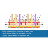 High Quality 808nm Hair Removal Diode Laser High Power Laser Diode Machines