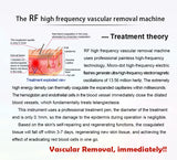 2021 Come The RF High Frequency Vascular Removal Blood Vessel Spider Vein Removals