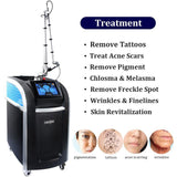 Discovery Pico Laser Picosecond Machine Medical Lasers Acne Spot Pigmentation Removal 755nm Cynosure Lazer Beauty Equipment