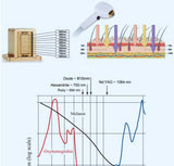 Three Wavelengths 750nm 808nm 1064NM Three-Length Diode Laser Machine