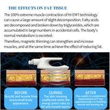 Emslim Body Contouring Slimming Postpartum Repair Build Muscle And Breaks Down Fat Spa Use