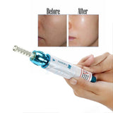 2021 Korea thesera Atomizer Sterile Hyaluronic Pen Therapy Gun Lip Lifting Injection Disposable