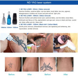 OPT SHR IPL ND Yag Laser Hair Removal Tattoo Remova E-light Skin Rejuventaion Facial Care